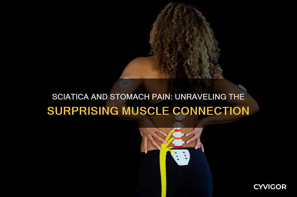 can sciatica also cause sore stomach muscles