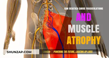 Sciatica Link to Fasciculations and Muscle Atrophy: What You Need to Know