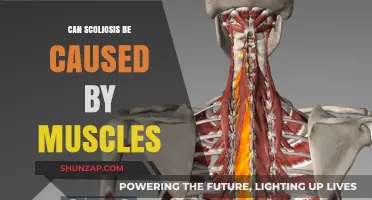 Muscle Imbalance and Scoliosis: Unraveling the Connection and Causes