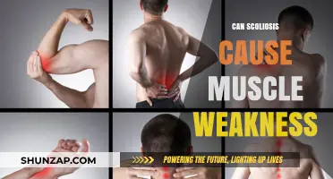 Can Scoliosis Lead to Muscle Weakness? Understanding the Connection