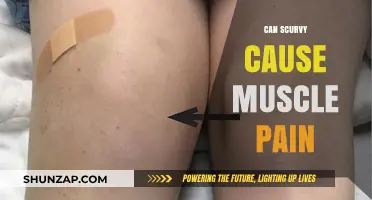 Scurvy and Muscle Pain: Uncovering the Surprising Connection