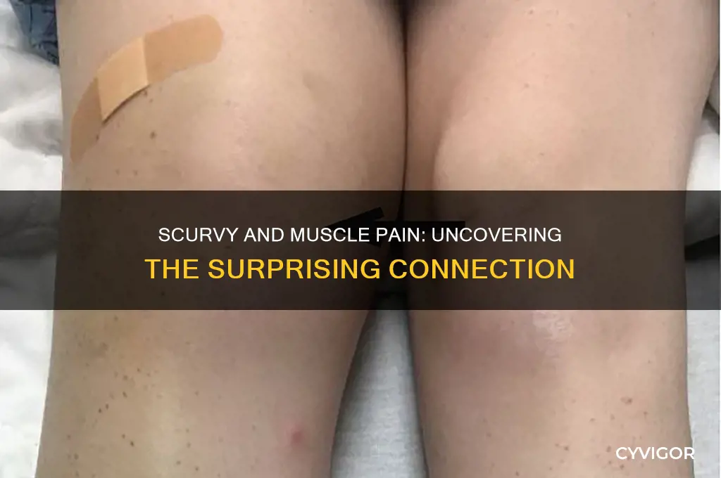 can scurvy cause muscle pain