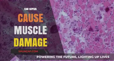 Sepsis and Muscle Damage: Understanding the Potential Risks and Impact