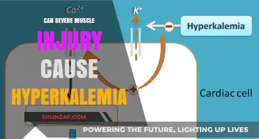Severe Muscle Injury and Hyperkalemia: Understanding the Critical Connection
