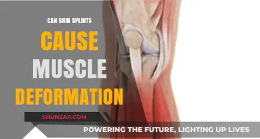 Shin Splints and Muscle Deformation: Understanding the Connection and Risks