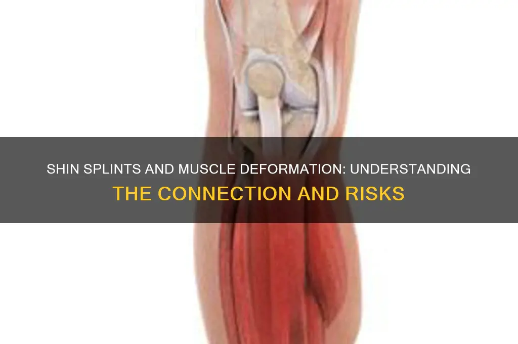 can shin splints cause muscle deformation