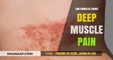 Can Shingles Trigger Deep Muscle Pain? Understanding the Connection