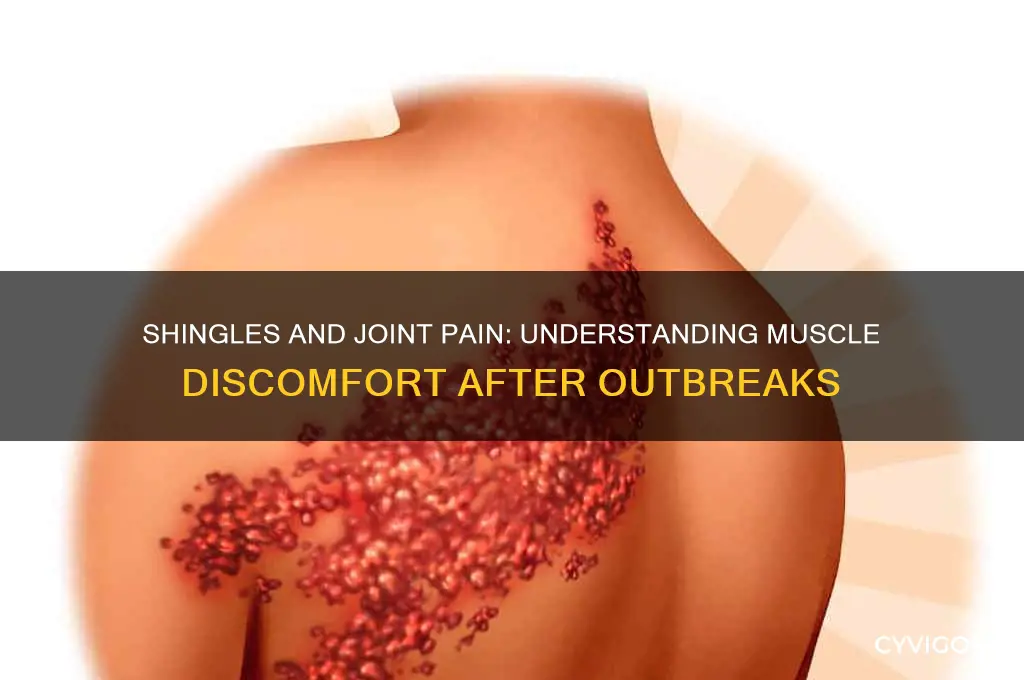 can shingles cause joint and muscle pain