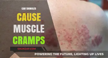 Shingles and Muscle Cramps: Understanding the Potential Connection