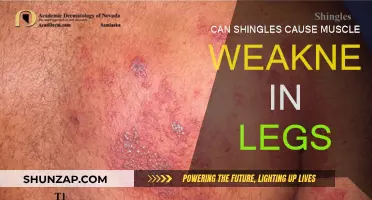 Shingles: Leg Muscle Weakness and Recovery