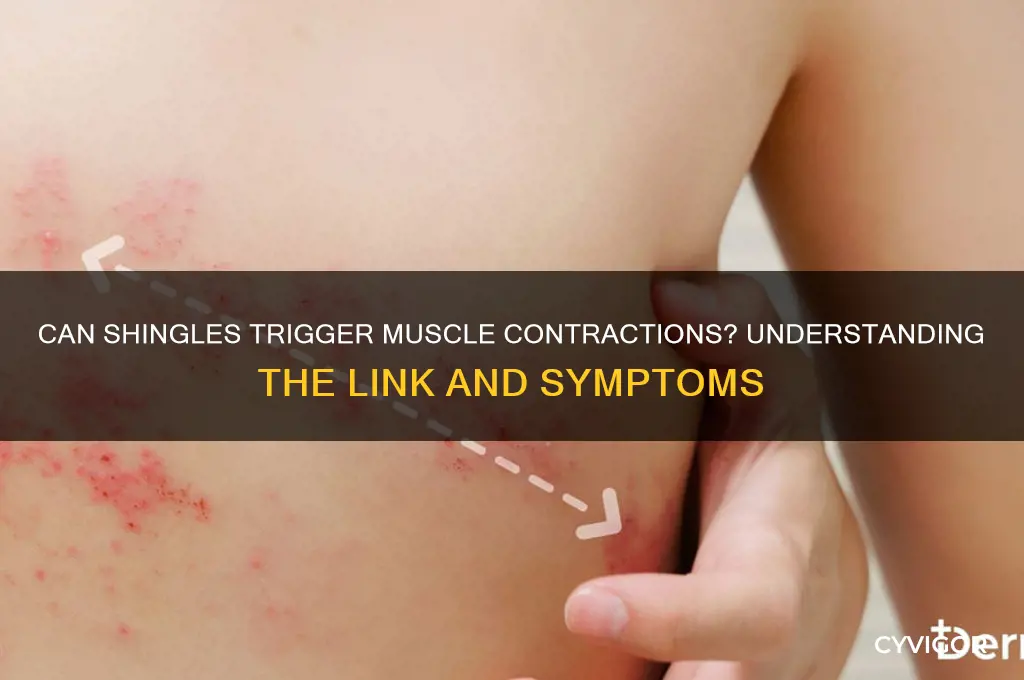 can shingles cause muscles to contract