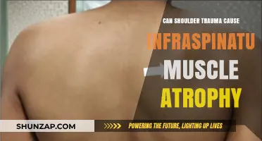 Shoulder Trauma and Infraspinatus Atrophy: Understanding the Connection