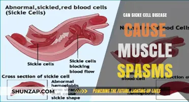 Sickle Cell Disease and Muscle Spasms: Understanding the Connection