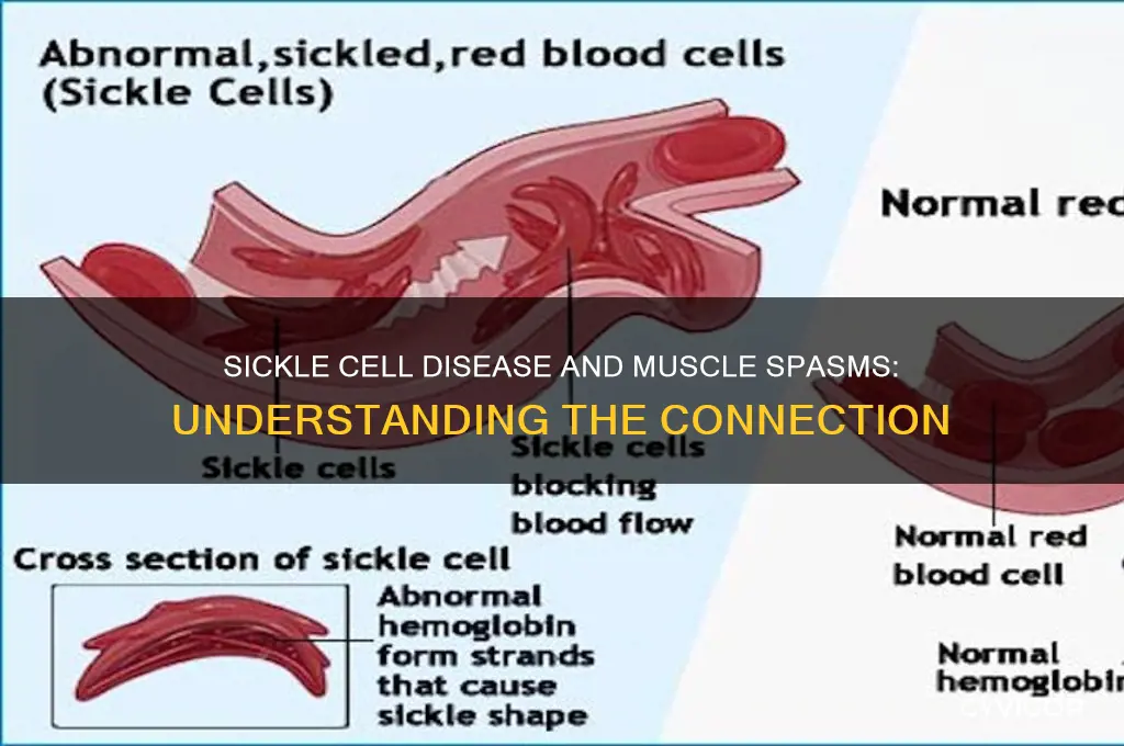 can sicke cell disease cause muscle spasms