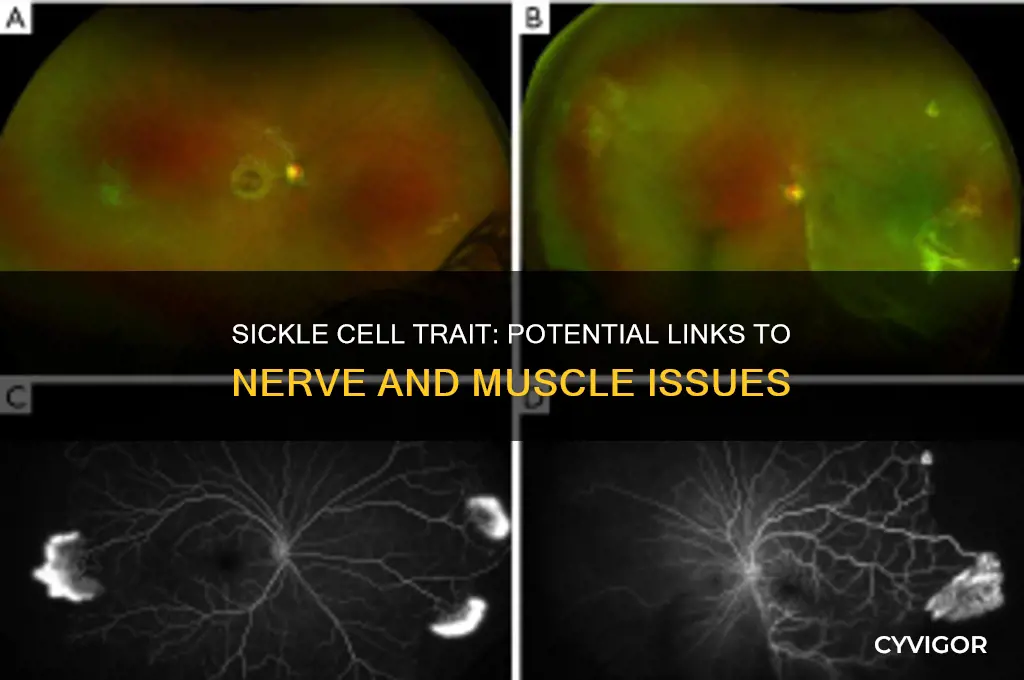 can sickle cell trait cause nerve or muscle problems