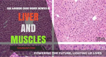 Sjogren's Syndrome: Link to Elevated Liver and Muscle Enzymes Explored