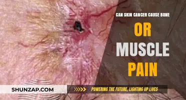 Skin Cancer and Pain: Exploring Bone and Muscle Discomfort Connections