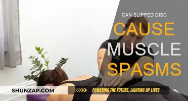 Slipped Disc: Understanding Muscle Spasms and Treatment