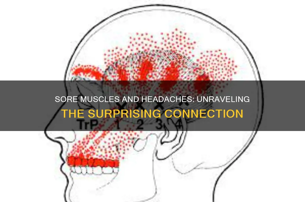 can sore muscles cause a headache