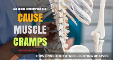 Spinal Cord Impingement: A Hidden Cause of Muscle Cramps?