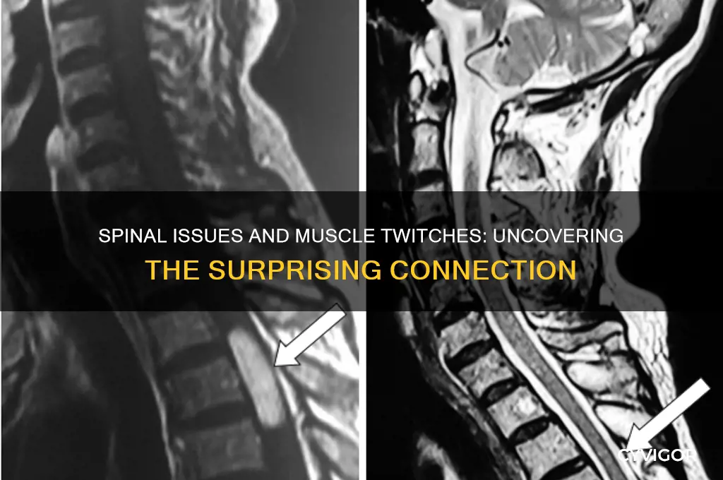 can spinal problems cause muscle twitches