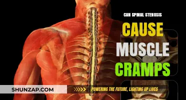 Spinal Stenosis and Muscle Cramps: Understanding the Connection and Relief