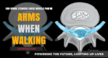 Spinal Stenosis and Arm Pain: Understanding the Walking Connection