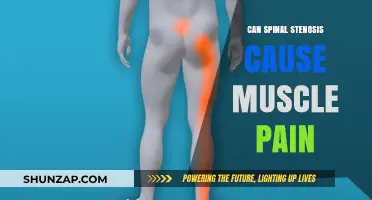 Can Spinal Stenosis Trigger Muscle Pain? Understanding the Connection