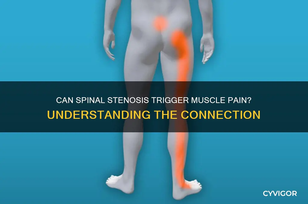 can spinal stenosis cause muscle pain