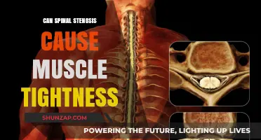 Spinal Stenosis and Muscle Tightness: Understanding the Connection
