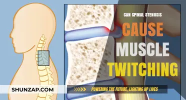 Can Spinal Stenosis Trigger Muscle Twitching? Understanding the Connection