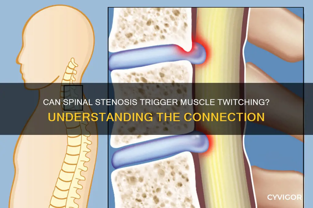 can spinal stenosis cause muscle twitching