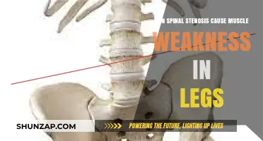 Spinal Stenosis and Leg Weakness: Understanding the Connection