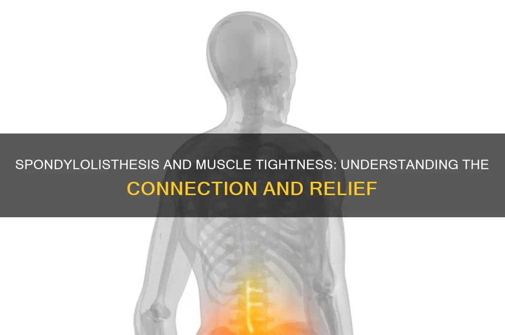 can spondylolisthesis cause muscle tightness