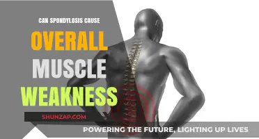Spondylosis and Muscle Weakness: Understanding the Connection and Impact
