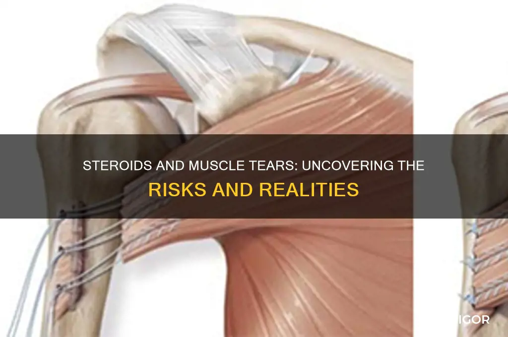 can steroids cause muscle tears