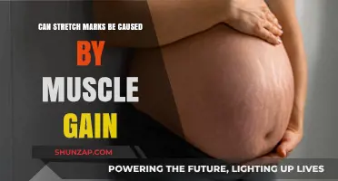 How Muscle Gain Stretches Your Skin and Causes Marks