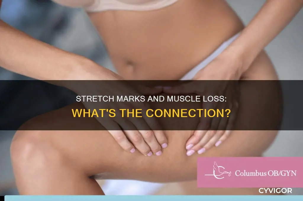 can stretch marks be caused by muscle loss
