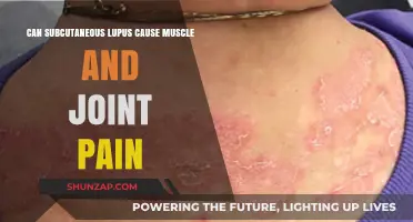 Lupus and Joint Pain: What's the Link?