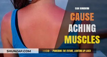 Sunburn and Muscle Pain: Is There a Link?