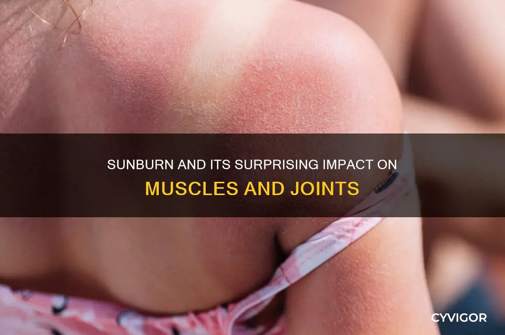 can sunburn cause muscle and joint pain