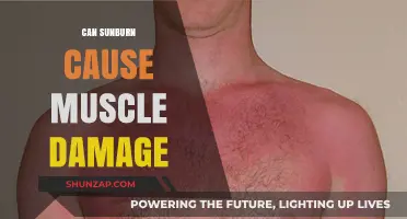 Sunburn's Impact: Exploring Muscle Damage Risks