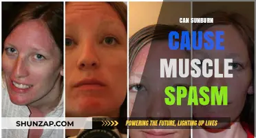 Sunburn and Muscle Spasms: What's the Connection?