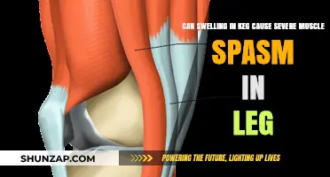Knee Swelling: A Cause of Severe Leg Muscle Spasms?