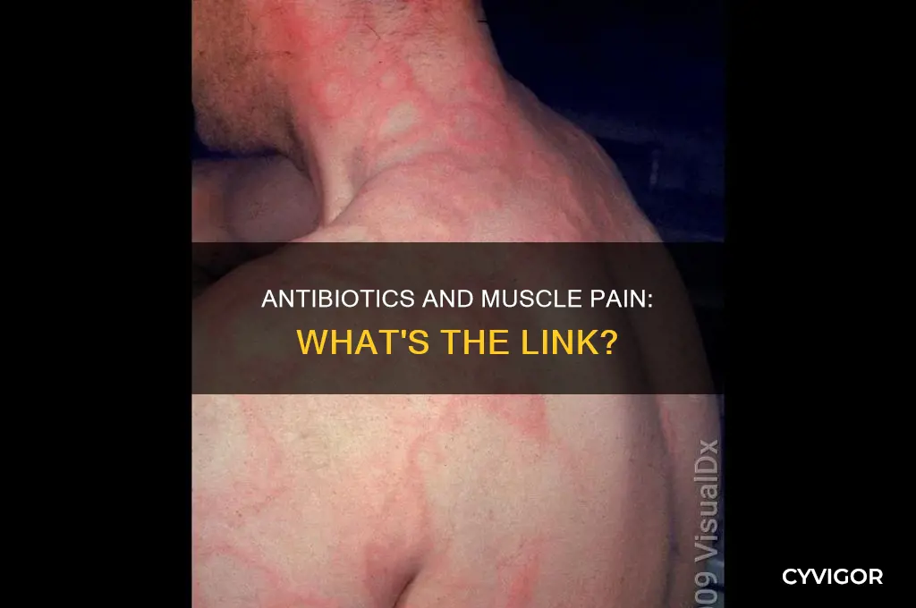 can taking antibiotics cause muscle pain