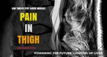 Tarlov Cysts: Thigh Muscle Pain Explained
