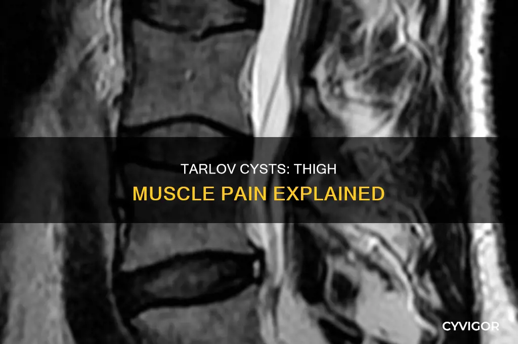 Tarlov Cysts: Thigh Muscle Pain Explained | CyVigor