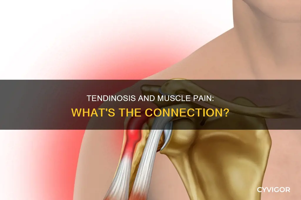can tendinosis cause muscle pain