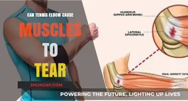 Tennis Elbow: Muscle Tears and Their Causes