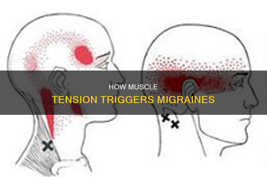 can tense muscles cause migraines